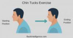 1-Chin-Tucks-Exercise.png