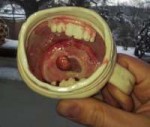 1-Disturbing-garage-sale-items-creepy-teeth-mug.jpg