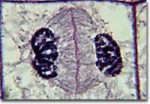 littlelateanaphase.jpg