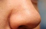 2018-04-28 230757-sebaceous filaments - Google Search.png