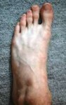 Foot,Narrow-large.jpg