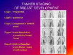 TANNER+STAGING+OF+BREAST+DEVELOPMENT.jpg