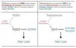 Prostaglandin-D2-DHT-Hair-Loss-Similartn.jpg