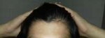 Hairline overview.jpg