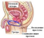 Строение-малого-таза-у-мужчины.jpg