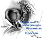 xprostam-photo.jpg.pagespeed.ic.51frmmqhA2.jpg