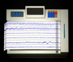 Encephalogramme 02.jpg