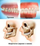 Vidy-cheljustnyh-anomalij.jpg