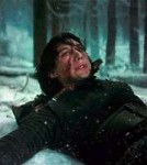 a4a09a21fb2d2db3e6ca2f61427c2303--kylo-ren-scar-burn-scars.jpg