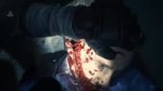 RESIDENT EVIL 2 REMAKE - 11 Minutes Of Gameplay Walkthrough[...].webm