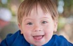 Down-syndrome-Affects-Child[1].jpg